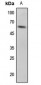 Anti-p53 (pS33) Antibody